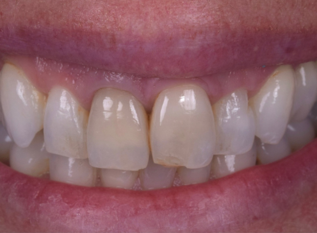 Before - Face Studio Dental