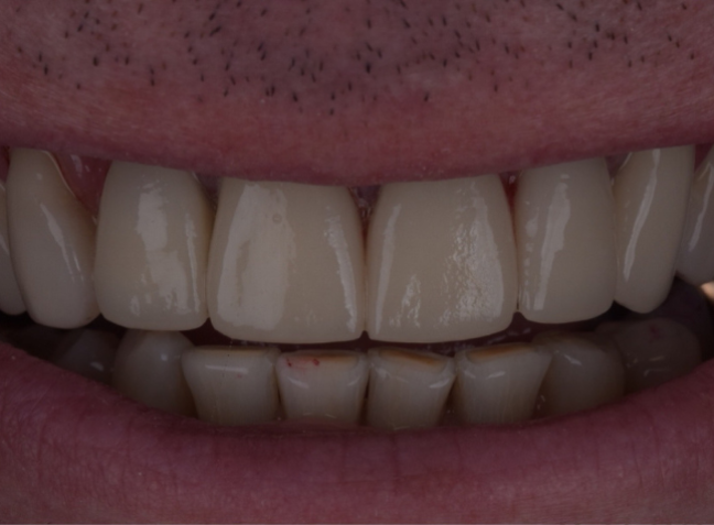 After - Face Studio Dental