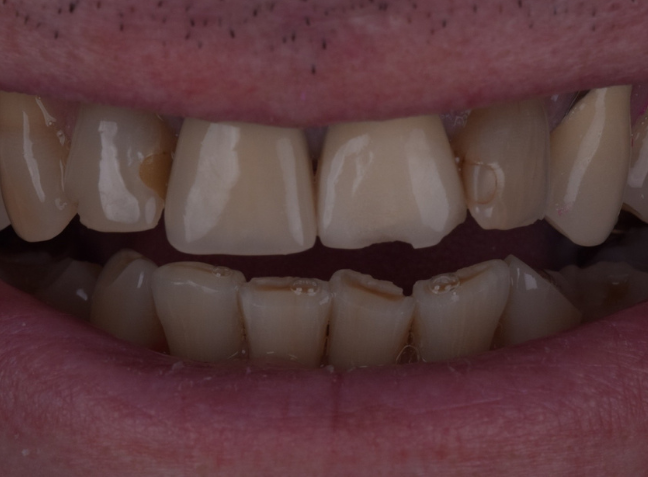 Before - Face Studio Dental