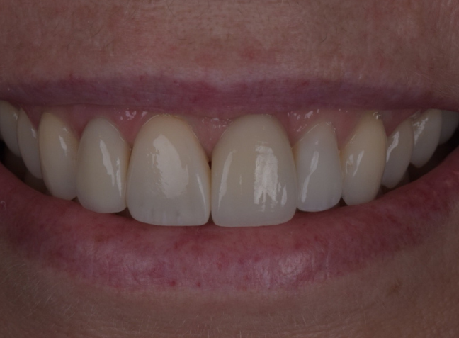 After - Face Studio Dental