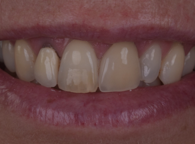 Before - Face Studio Dental