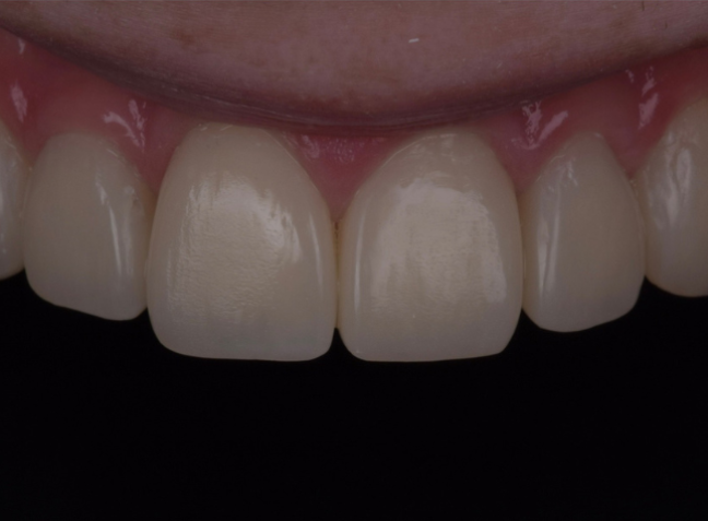 After - Face Studio Dental