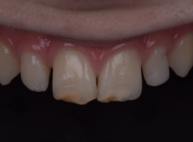 Before - Face Studio Dental