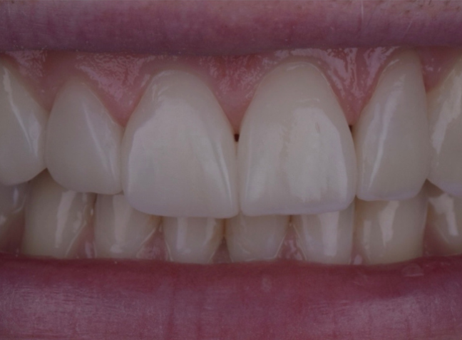 After - Face Studio Dental