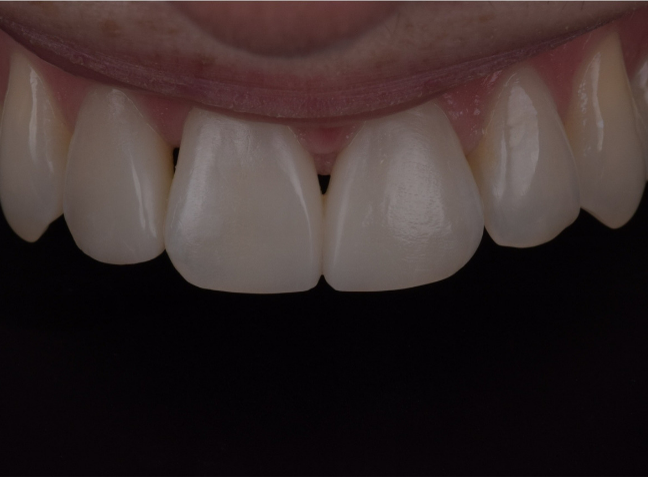 After - Face Studio Dental