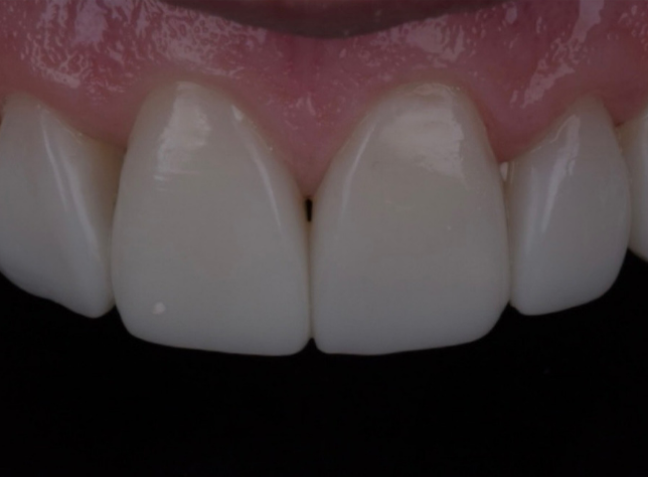 After - Face Studio Dental