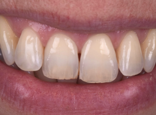 Before - Face Studio Dental