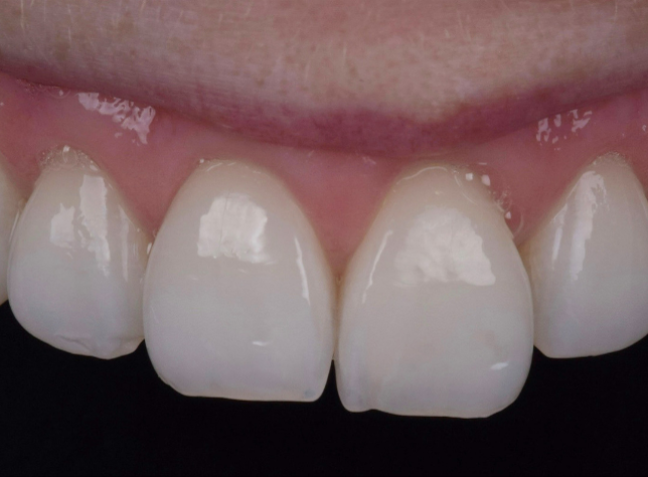 Before - Face Studio Dental