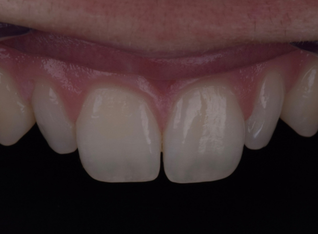 Before - Face Studio Dental