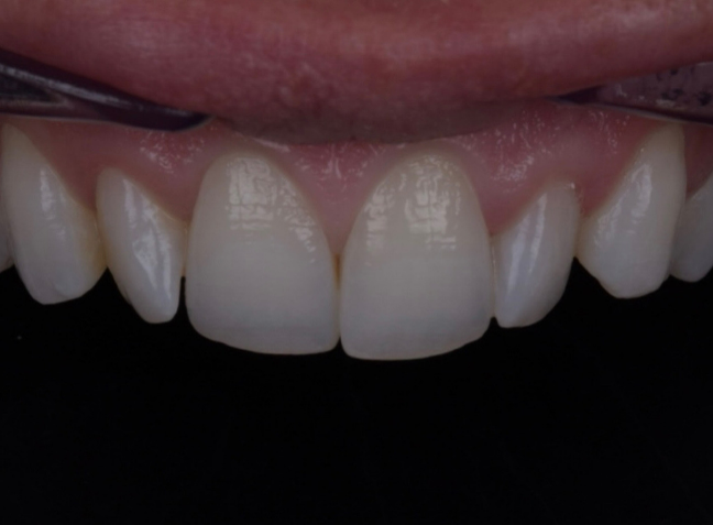 Before - Face Studio Dental