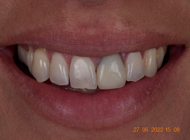 Before - Face Studio Dental