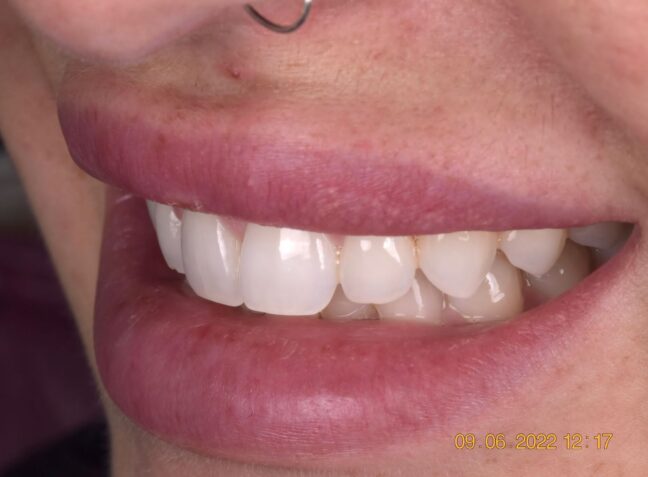 Before - Face Studio Dental