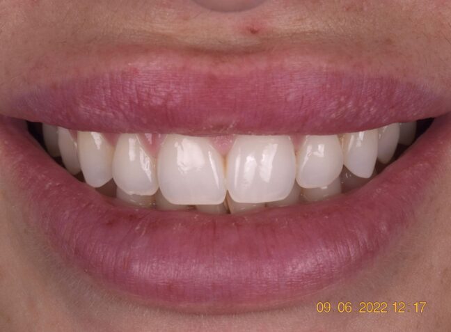 Before - Face Studio Dental